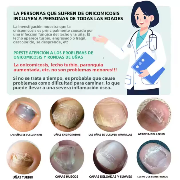 "Gotas Mágicas para el Cuidado de Uñas – ¡Llévate 2 GRATIS!" - Image 4