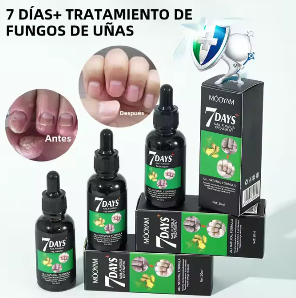 "Gotas Mágicas para el Cuidado de Uñas – ¡Llévate 2 GRATIS!" - Image 5