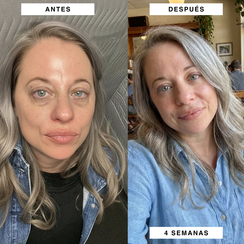 Parches PuraDerma™ - Reduce las ojeras - Image 2