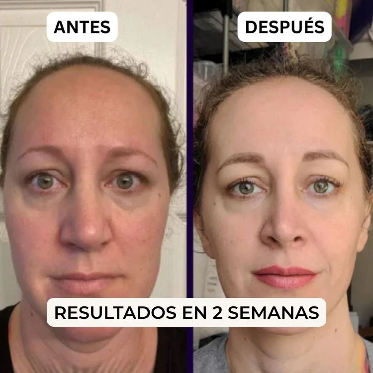 Parches PuraDerma™ - Reduce las ojeras - Image 6