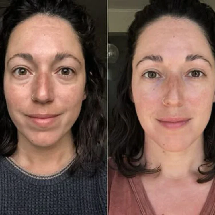 Parches PuraDerma™ - Reduce las ojeras - Image 7
