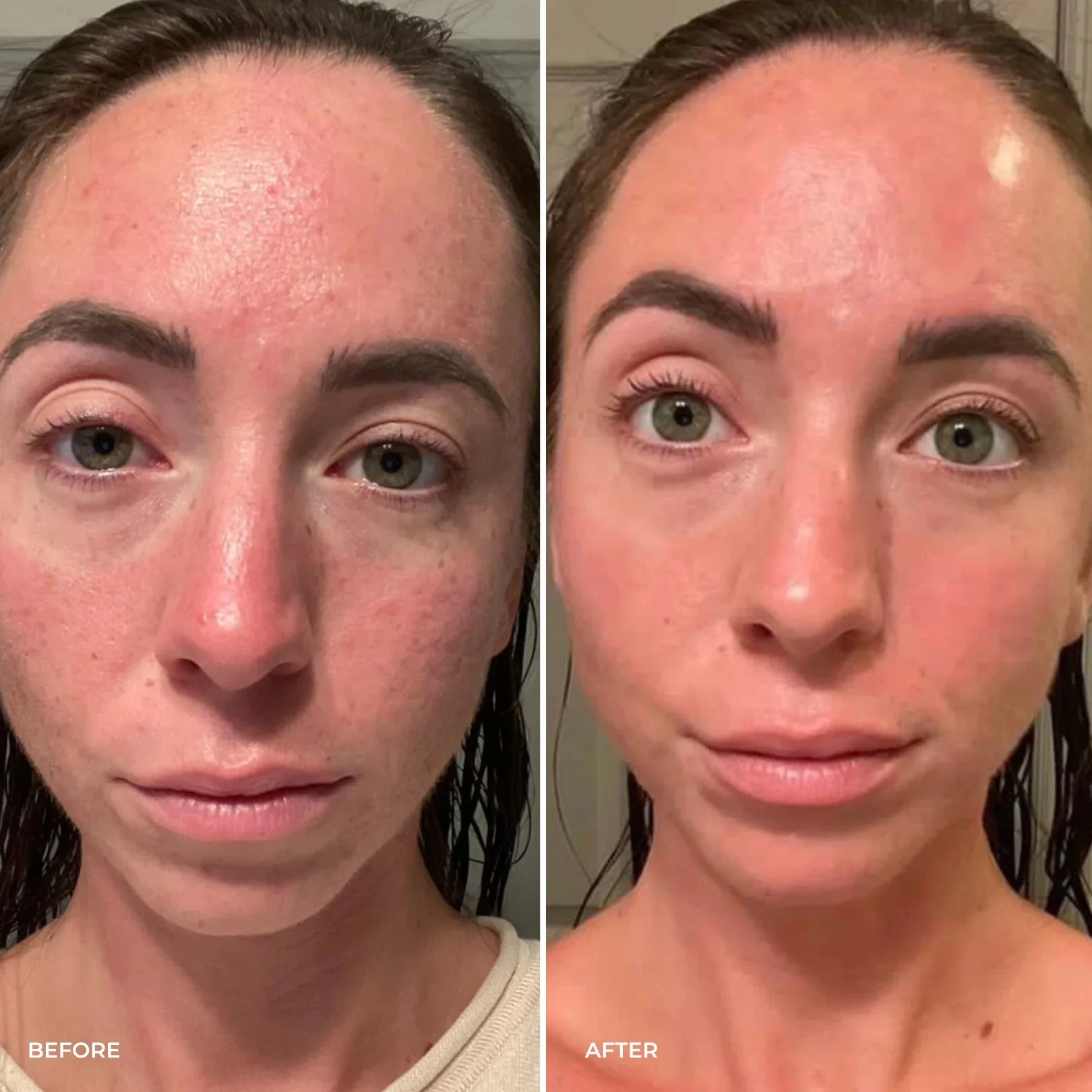 Parches PuraDerma™ - Reduce las ojeras - Image 8