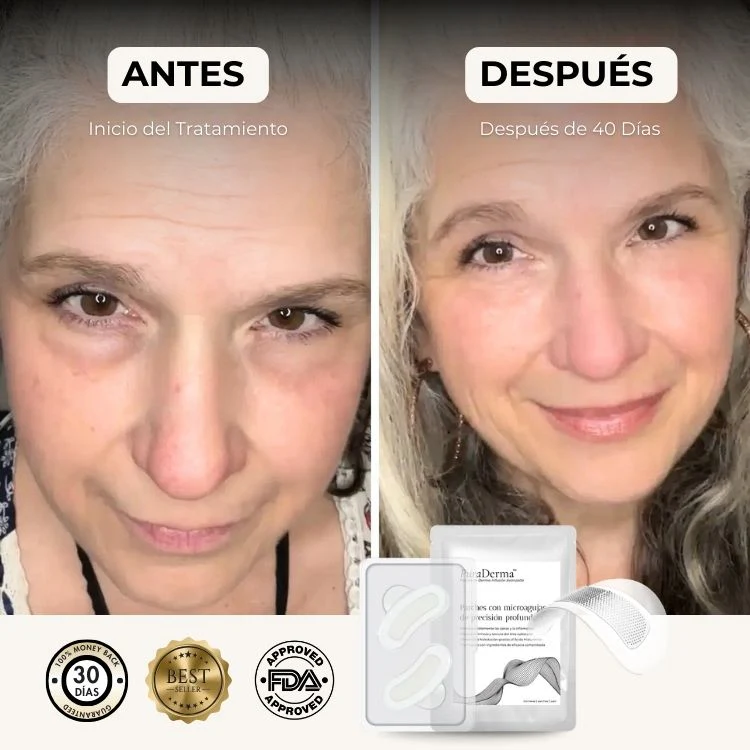 Parches PuraDerma™ - Reduce las ojeras - Image 9
